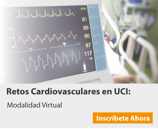 Retos Cardiovasculares en UCI