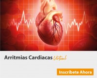 arritmias-cardiacas-miniatura